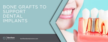 Bone grafts to support dental implants