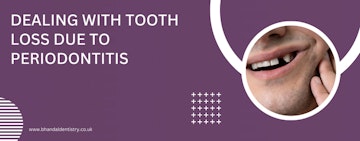 Dealing with tooth loss due to periodontitis