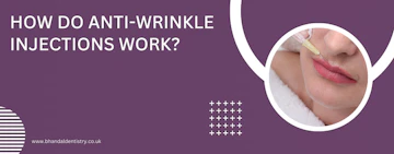 How Do Anti-wrinkle injections Work