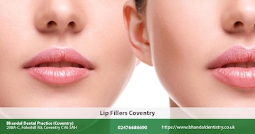 Lip Fillers Coventry