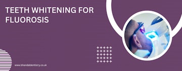 Teeth whitening for fluorosis