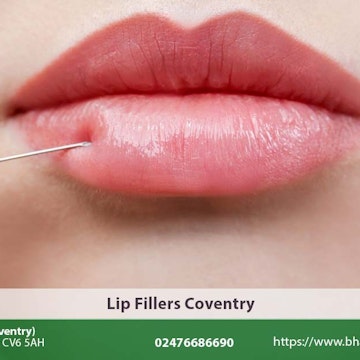 Lip Fillers Coventry